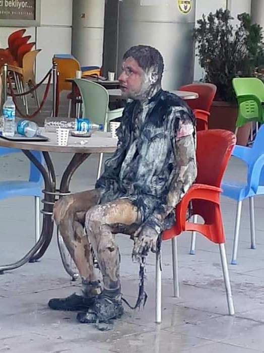 Kendini Yakan Genç Hayata Tutunamadı
